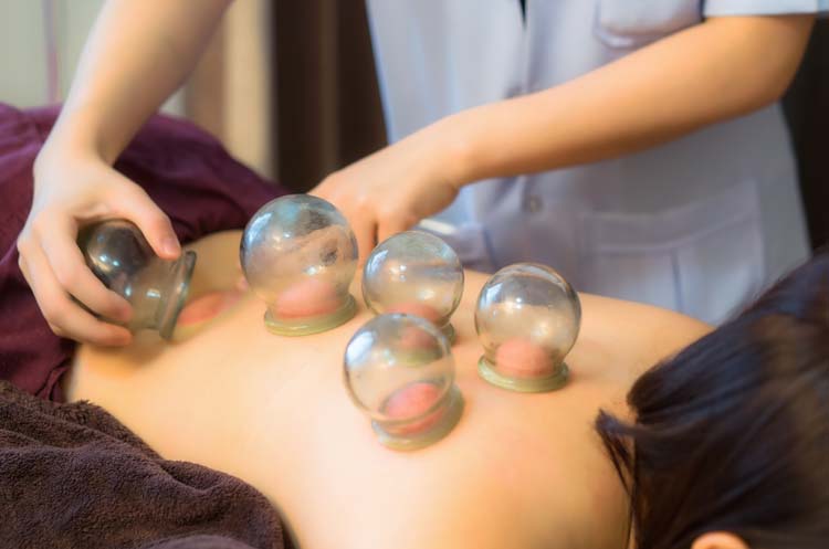 Acupuncture Miami